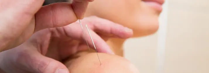 acupuncture in Chillicothe OH